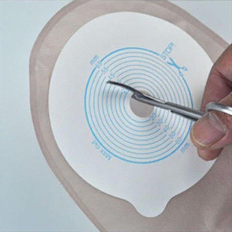 Ostomy Bags Scissors Round Hea - Medical Scissors 评论和价格